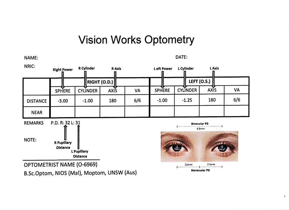 FAQ | Vision Works Optometry